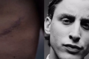 罗体：博维拍摄香水广告，首次展示了自己接受心脏手术后的伤疤